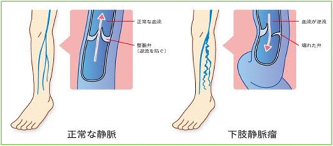 呼出方法